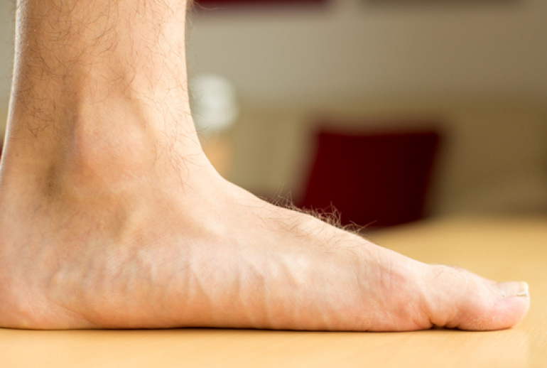 دکتر کف پای صاف - ( کرج )